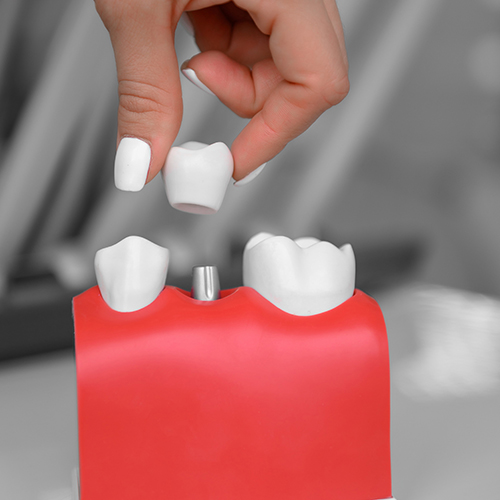 Pediatric Dentistry